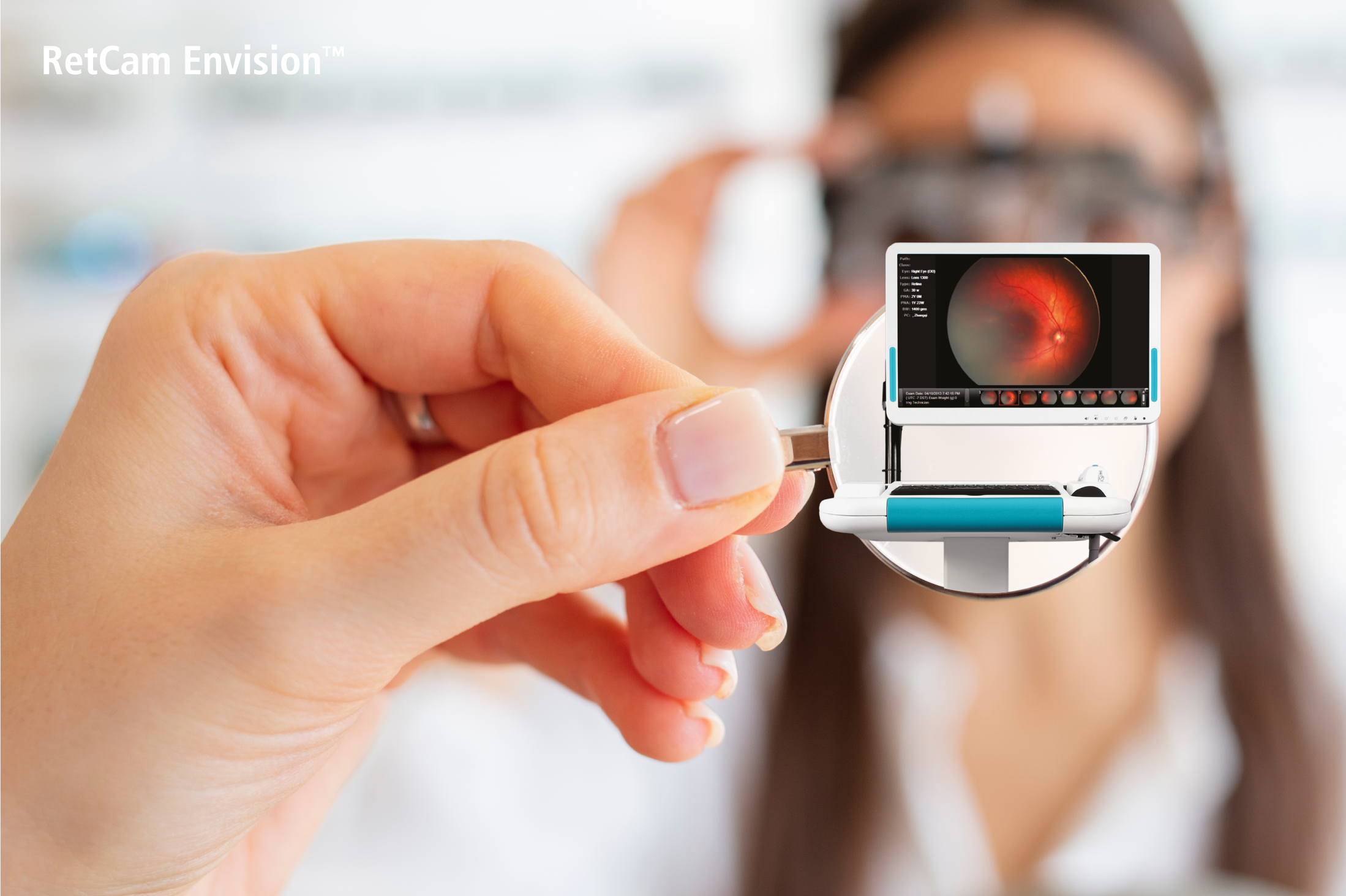 O que faz do Retcam Evision o melhor investimento entre os retinógrafos?