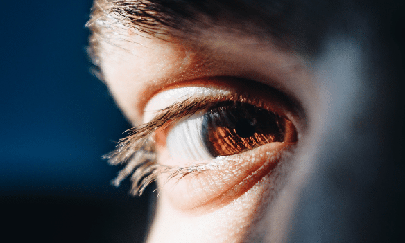 Visão com miopia: cirurgia com lente intraocular é para todo paciente?