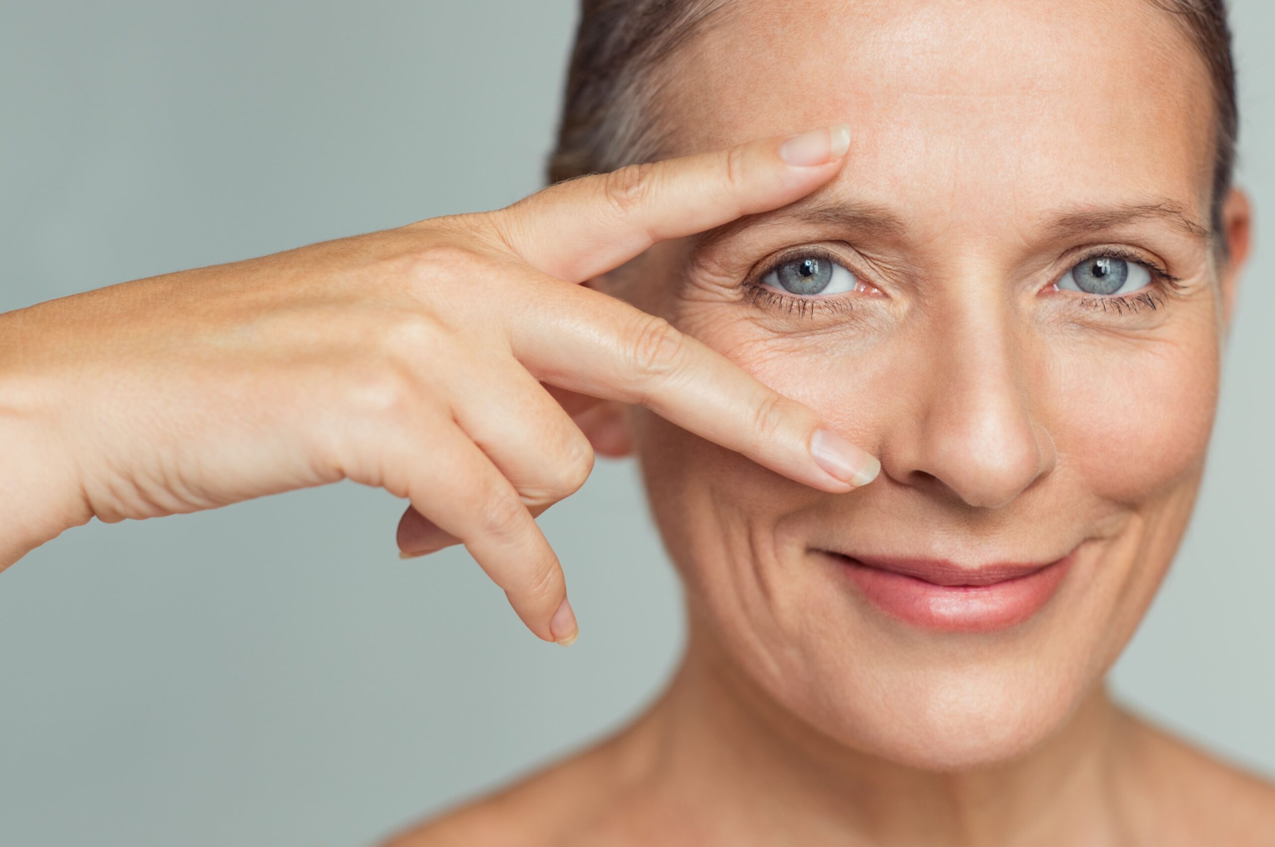 Ptose adquirida: o que é e como tratá-la
