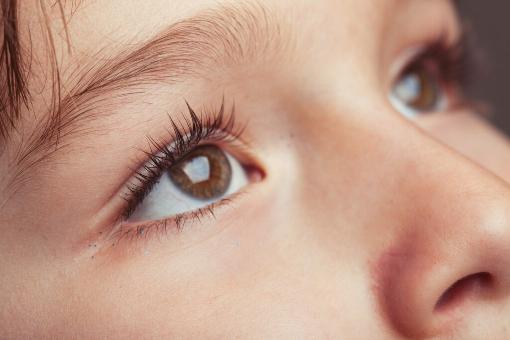 Saiba como prevenir descolamento de retina em crianças