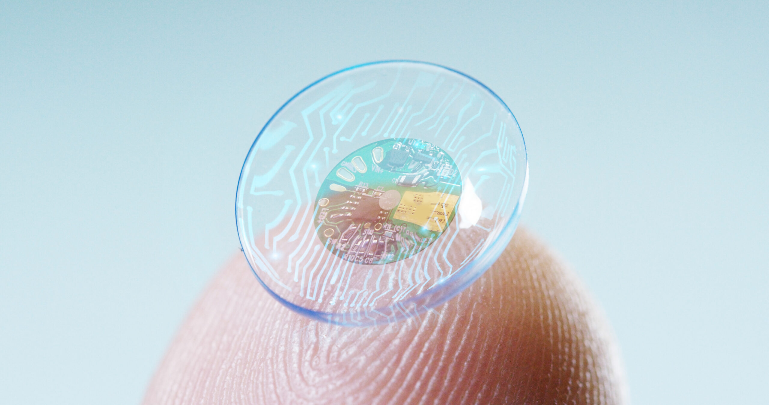A vida após o implante de íris artificial