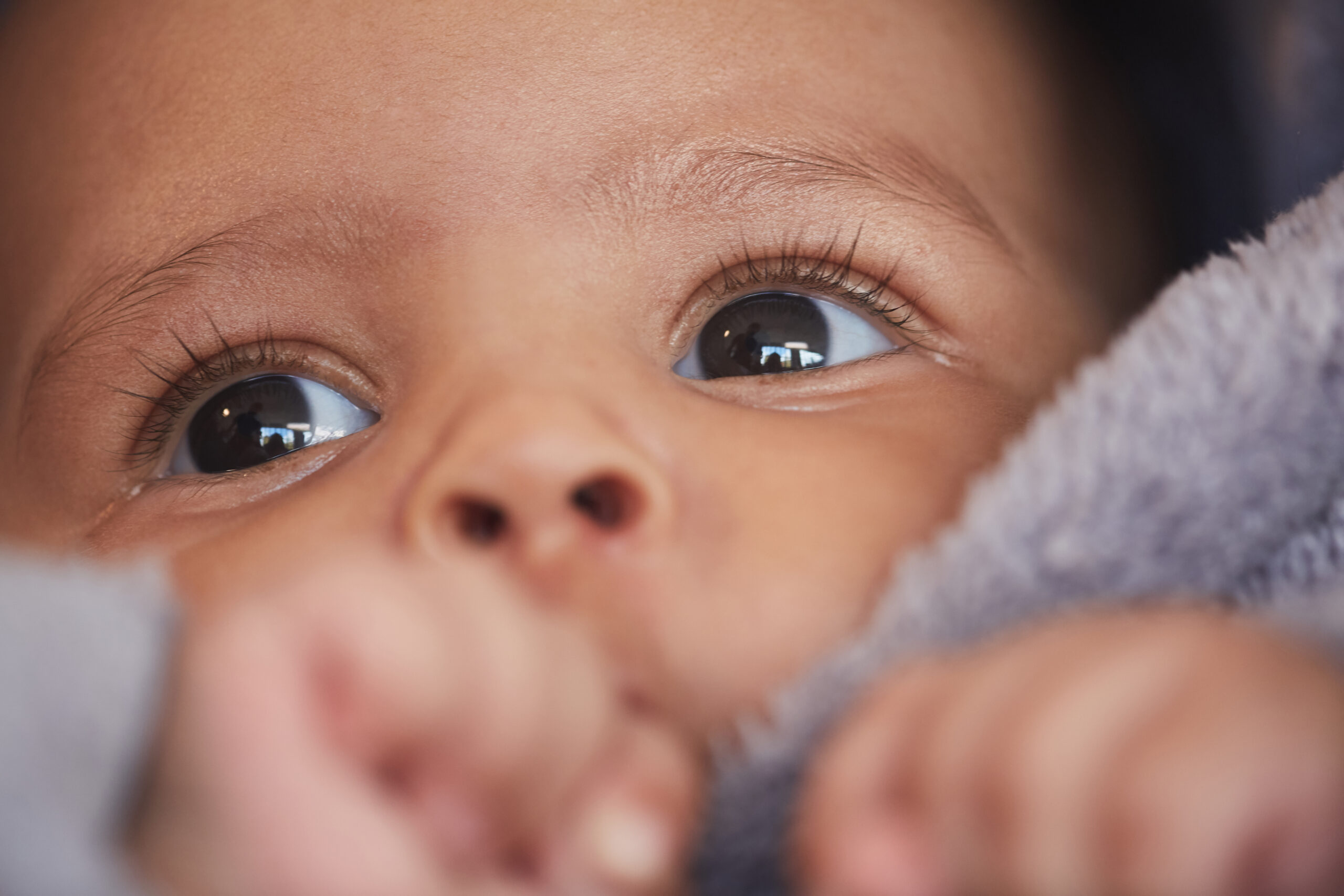 Celulite Ocular em Crianças: Causas, Sintomas e Cuidados Essenciais