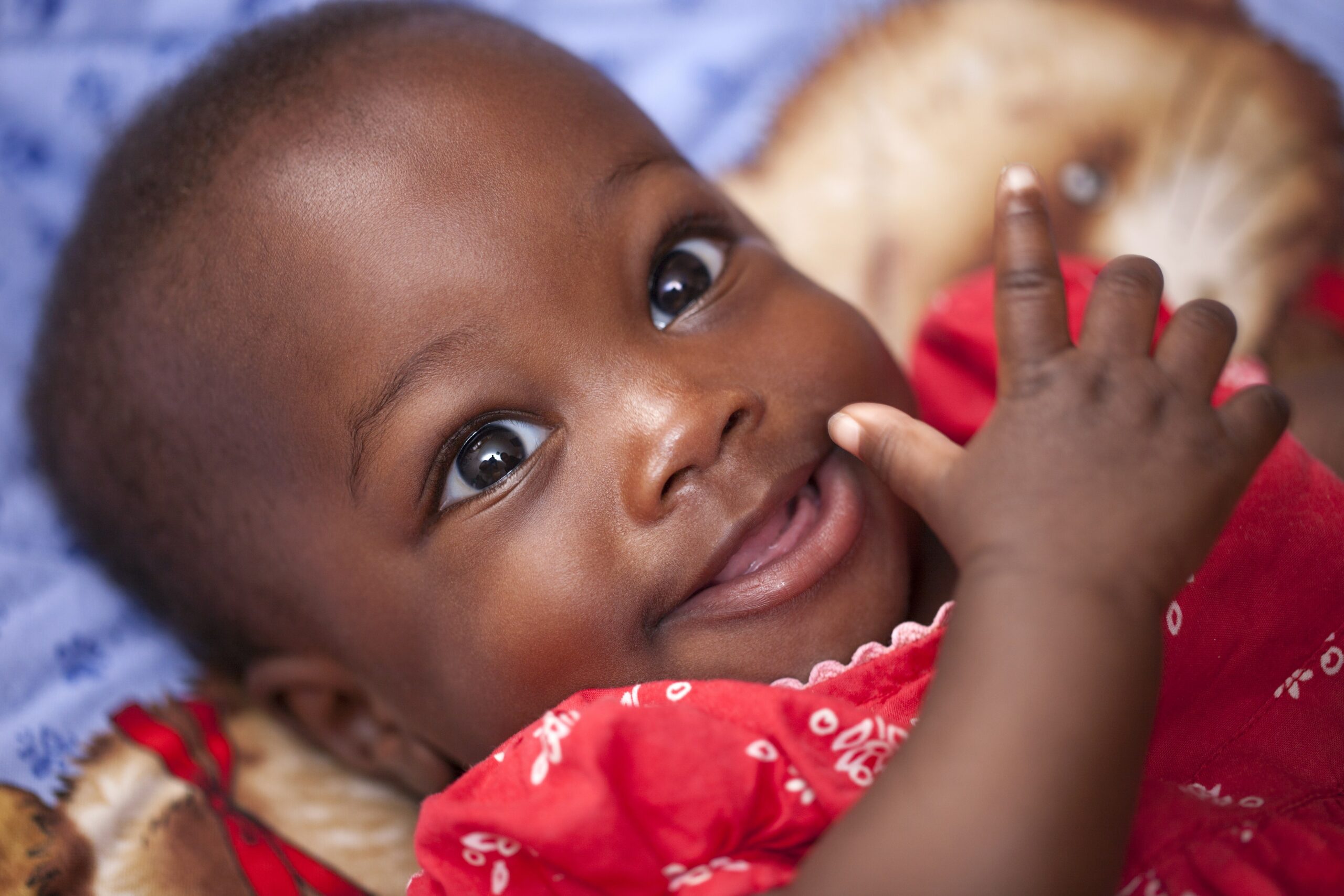 Retinoblastoma em bebês: como identificar