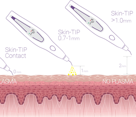 Aplicação clínica com Plexr Plus