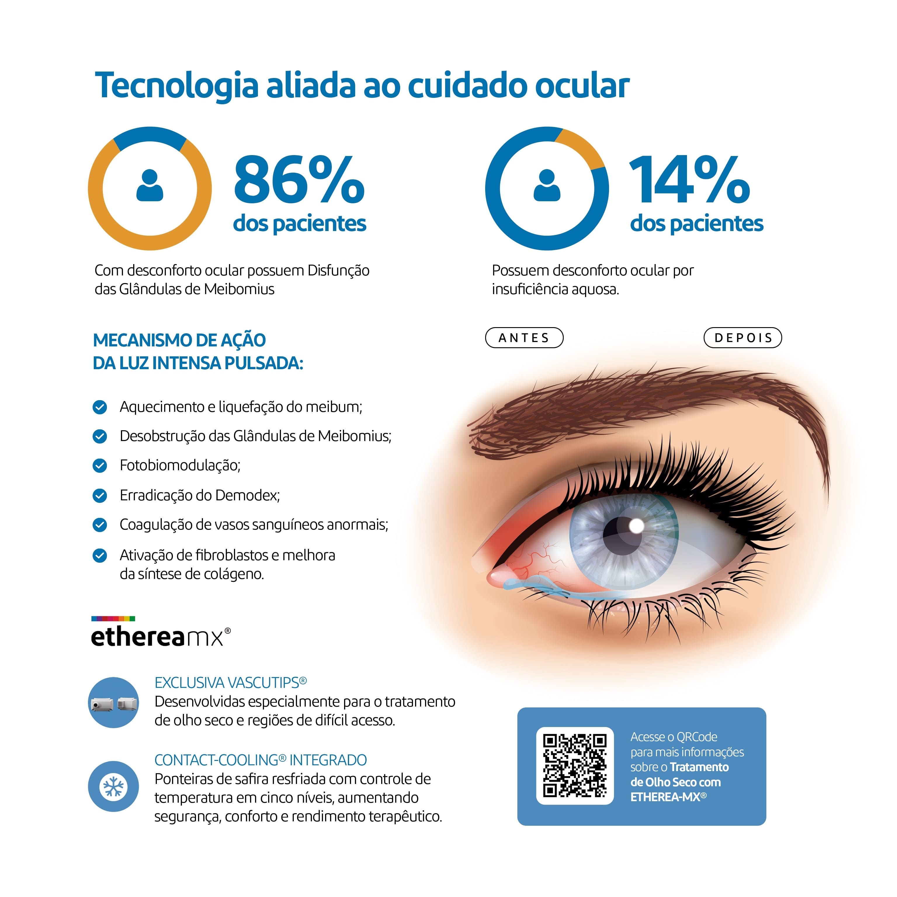 Tecnologia aliada ao cuidado ocular com Etherea MX