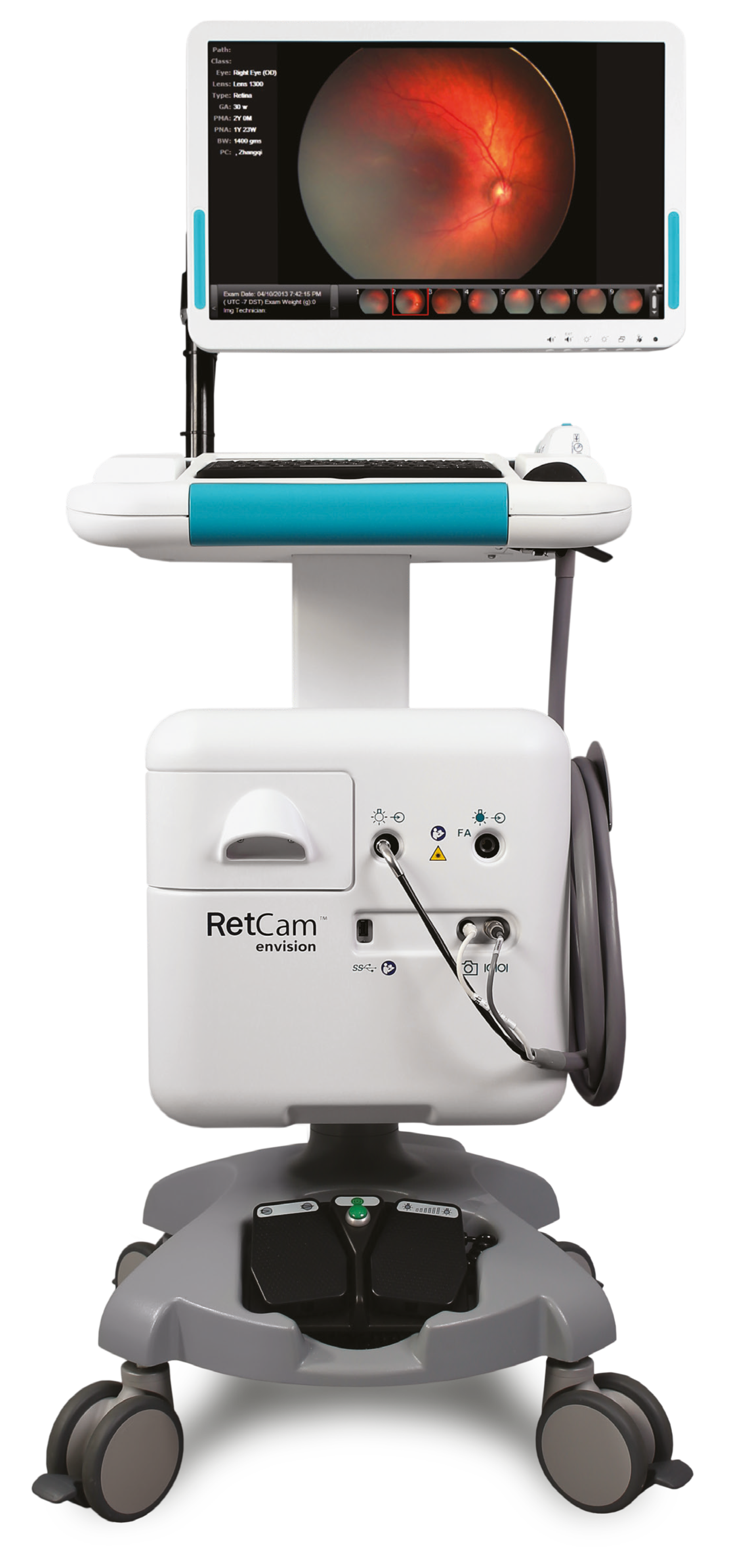 RetCam Envision